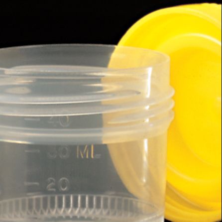 Biztonsági záras mintatároló edények