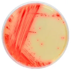 CHROMagar™ Mycoplasma